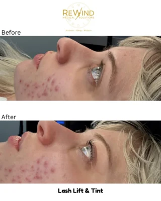 Instagram post from rewindmedicalsolutions. This post is in position 5.